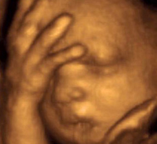 ultrasound of human fetus 30 weeks exactly