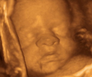 ultrasound of human fetus 30 weeks and 4 days