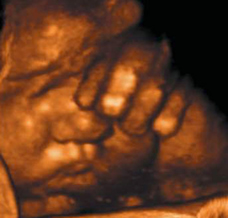 ultrasound of human fetus 39 weeks and 3 days