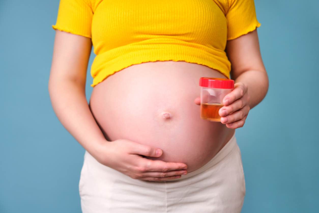 Protein in Urine During Pregnancy: What to Know About Proteinuria