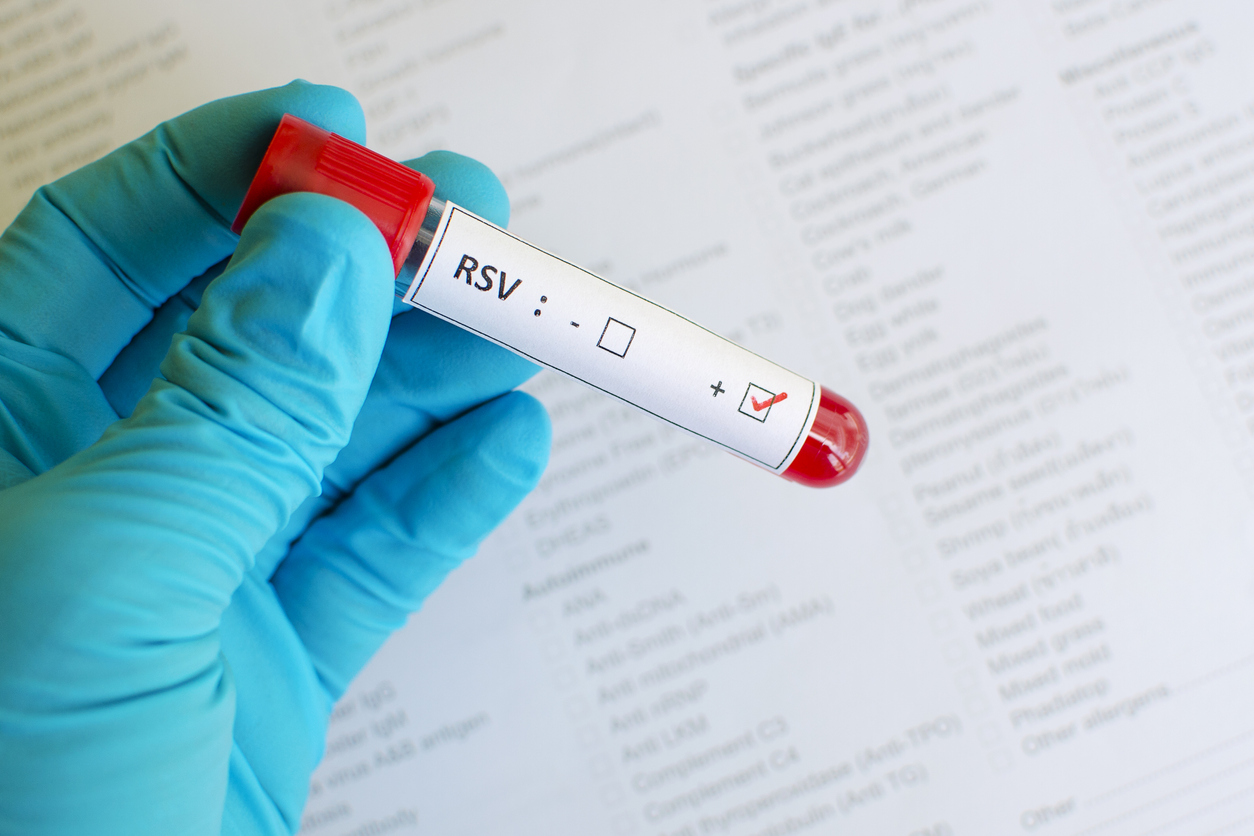 Is There a Test for RSV?