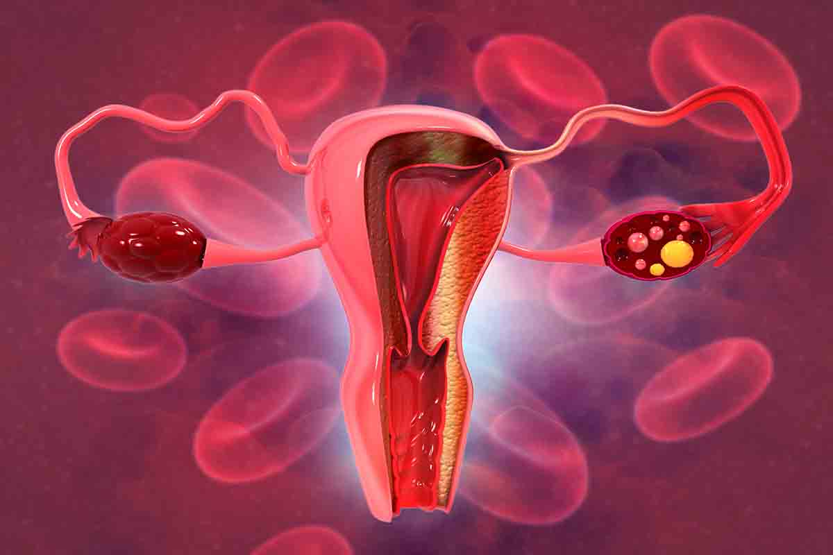 Menstrual Cycle Bleeding