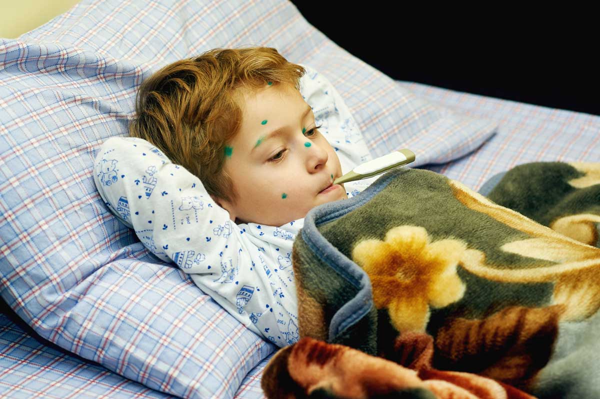 Sick child lying in bed with chicken pox