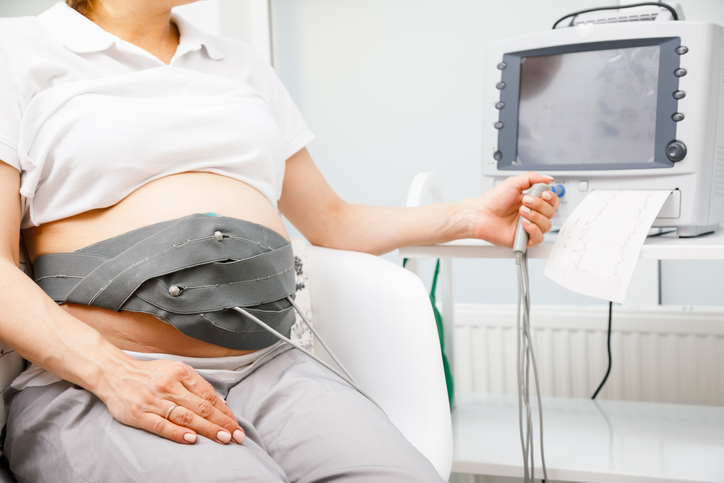 woman getting a nonstress test for overdue pregnancy 