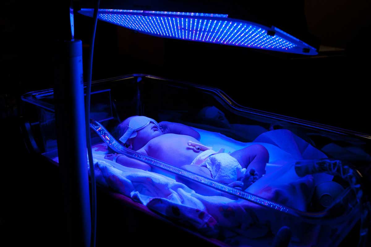 Newborn baby with jaundice under blue UV light for phototheraphy