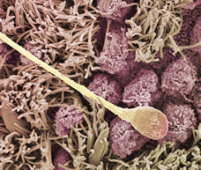 sperm cell traveling along fallopian tube