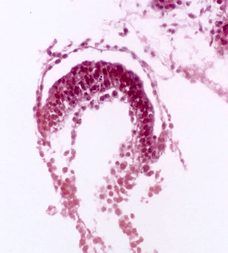 amniotic cavity of embedded blastocyst