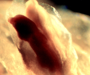 ultrasound of human embryo at 4 weeks 6 days