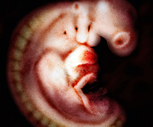 human embryo at 6 weeks and 3 days