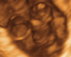 human embryo at 6 weeks and 5 days