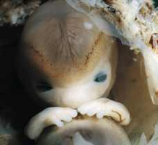 human embryo at 7 weeks and 2 days