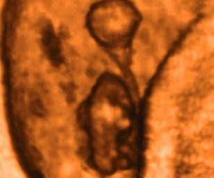 ultrasound of yolk sac at 7 weeks and 6 days