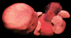 ultrasound of human embryo at 9 weeks exactly