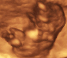 ultrasound of human fetus at 9 weeks and 6 days