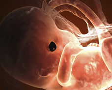 ultrasound of human fetus at 10 weeks exactly