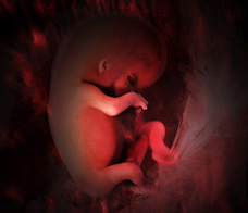 ultrasound of human fetus at 10 weeks and 1 day