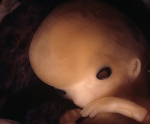 face and hands of human fetus at 11 weeks exactly