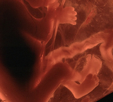 Weeks ultrasound days 4 4 First trimester