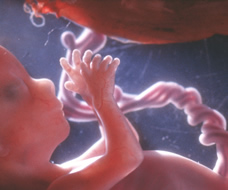 ultrasound of human fetus at 14 weeks and 1 day