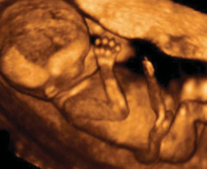 ultrasound of human fetus at 14 weeks and 5 days