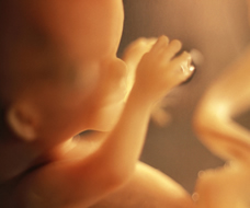 ultrasound of human fetus at 15 weeks exactly