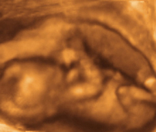 ultrasound of human fetus at 15 weeks and 6 days