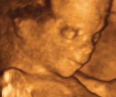 ultrasound of human fetus at 16 weeks exactly
