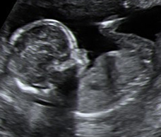 ultrasound of human fetus at 16 weeks and 4 days