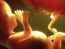 human fetus and placenta at 18 weeks and 1 day