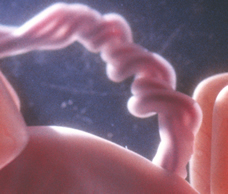 placenta of human fetus at 18 weeks and 3 days