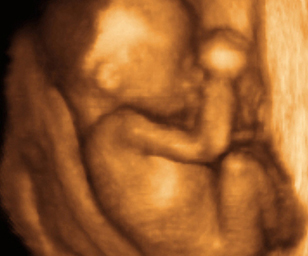 ultrasound of human fetus at 19 weeks and 2 days