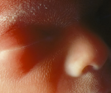 face of human fetus at 21 weeks exactly