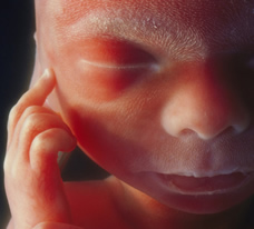ultrasound of human fetus at 21 weeks and 1 day