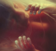 ultrasound of human fetus at 21 weeks and 5 days