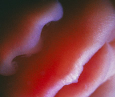 mouth and nose of human fetus at 22 weeks and 3 days