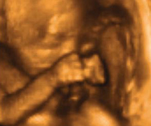 ultrasound of human fetus at 23 weeks and 6 days