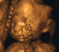 ultrasound of human fetus at 25 weeks and 5 days