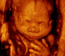 ultrasound of human fetus at 26 weeks exactly