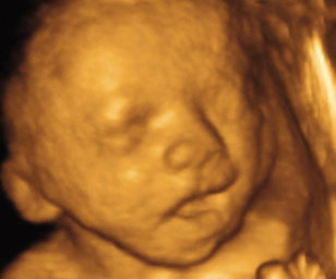 ultrasound of human fetus as 27 weeks and 3 days