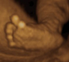 feet of human fetus as 29 weeks exactly