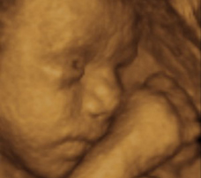 ultrasound of human fetus 29 weeks and 1 day