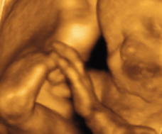ultrasound of human fetus 29 weeks and 3 days