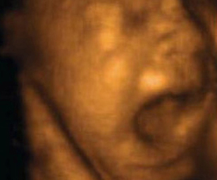 ultrasound of human fetus 30 weeks and 1 day
