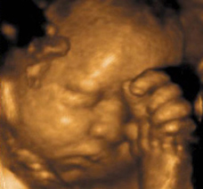ultrasound of human fetus 31 weeks and 3 days