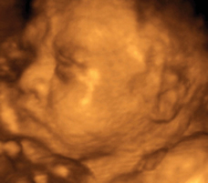 ultrasound of human fetus 31 weeks and 5 days