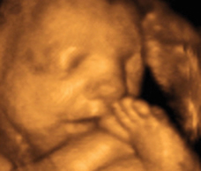 ultrasound of human fetus 32 weeks and 1 day