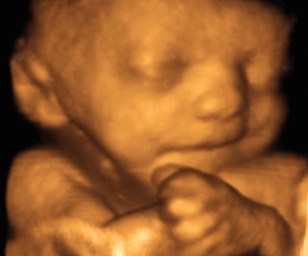 ultrasound of human fetus 32 weeks and 2 days