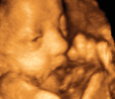 ultrasound of human fetus at 33 weeks and 6 days