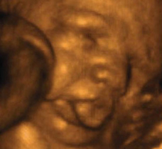 ultrasound of human fetus at 34 weeks and 3 days