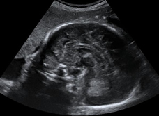 ultrasound of human fetus at 35 weeks exactly